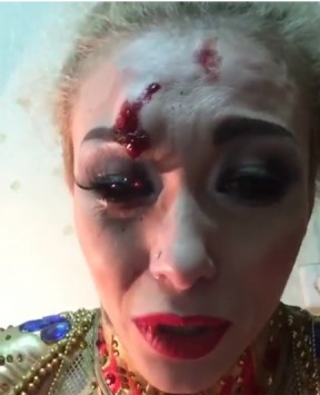 Екатерина Запашная разбила лицо во время выступления в Кирове