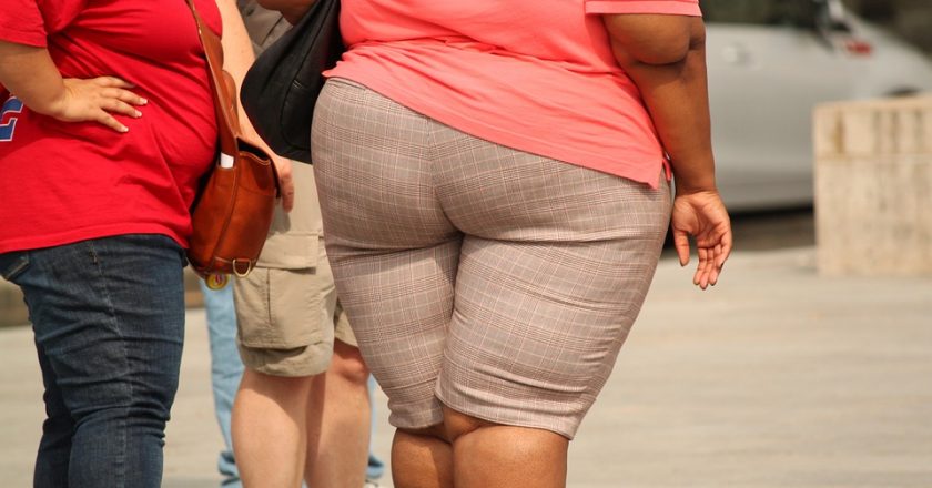 Ученые заявили, что ожирение приводит к изменениям в мозге