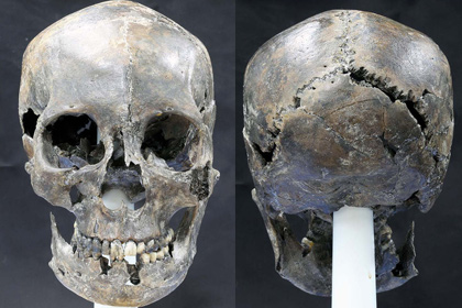 Ученые обнаружили в Южной Корее необычный женский череп