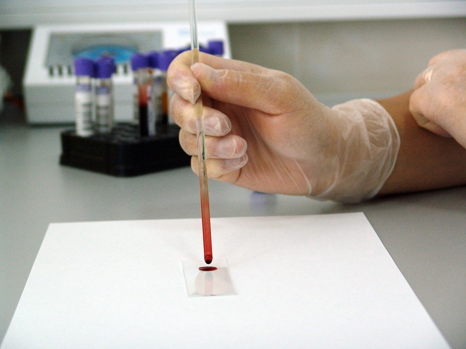 Ученые: анализ крови позволит определить дату смерти