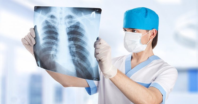 В Кировской области март объявили месяцем профилактики туберкулеза